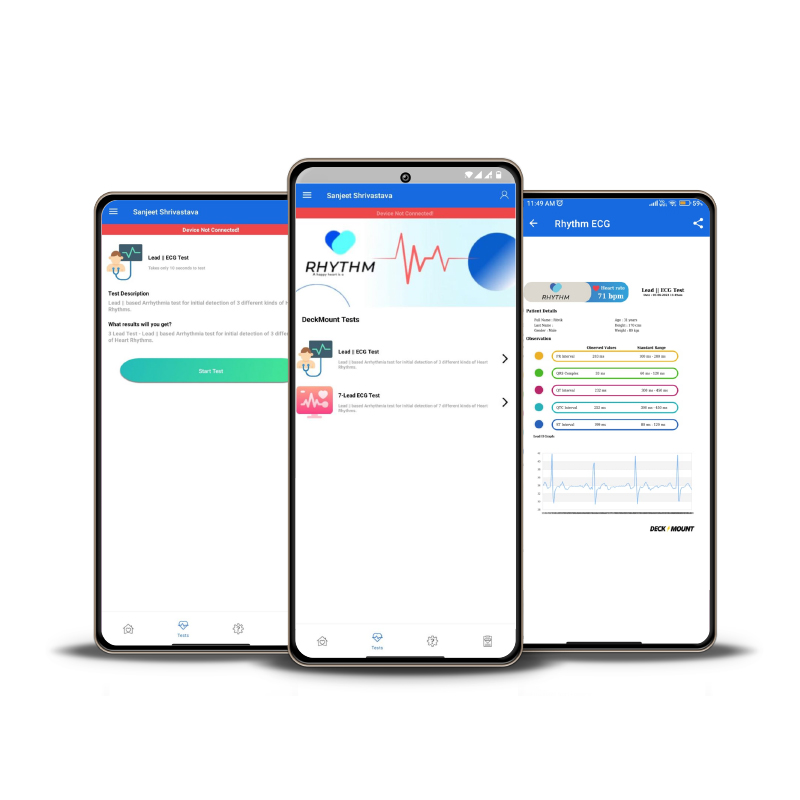 Rhythm Pocket ECG - Image 4